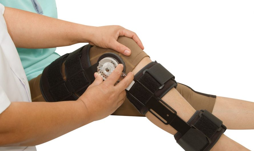 Artificial Limbs and Joints Market  by Type | Application  | Demand