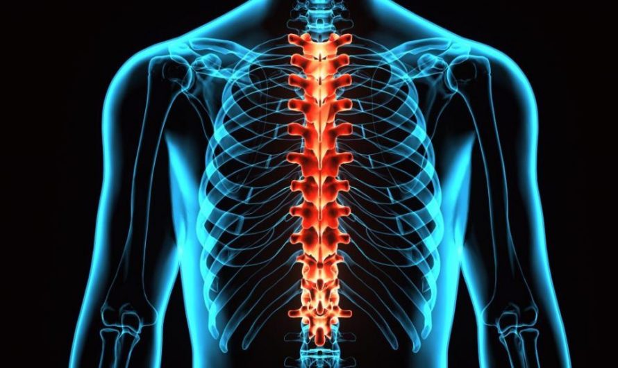 Spinal Implants Market In Global (2019-2024)