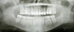 Cone Beam Computed Tomography Market
