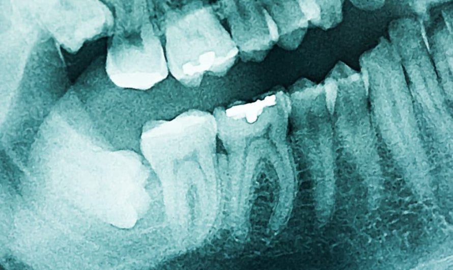 Dental Imaging Market Size, Share and Manufacturing Cost Analysis