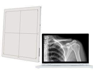 Digital Radiography Systems Market