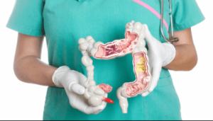 Familial Adenomatous Polyposis Treatment Market