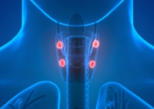 Hypercalcemia Market