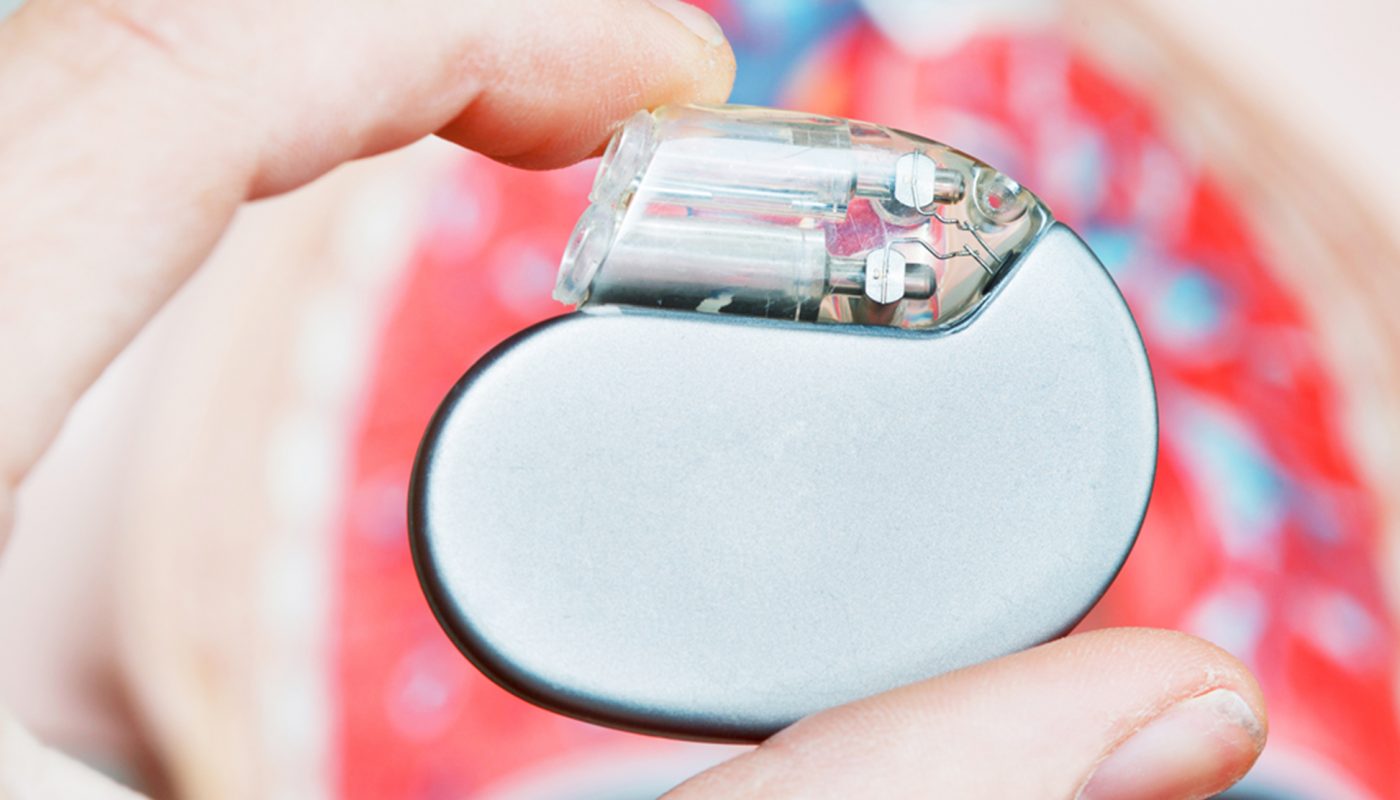 Implantable Cardioverter Defibrillators Market