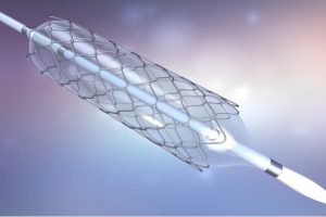 Interventional Cardiology and Peripheral Vascular Devices Market