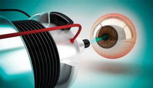 Medical Lasers Market