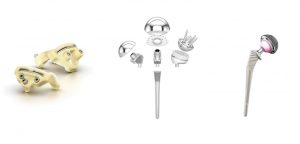 Shoulder Reconstruction Products Market
