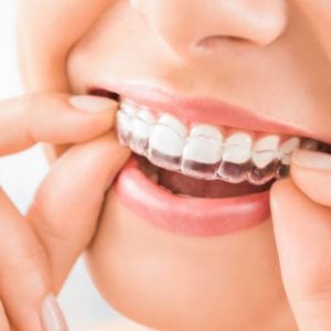 Cosmetic Dentistry Market