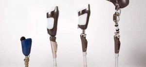 Dental Impression Systems Market