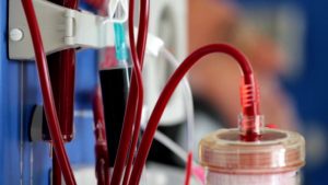 Dialyzer Market