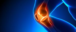 Knee Arthroplasty Market