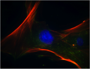 Mesenchymal Stem Cells Market