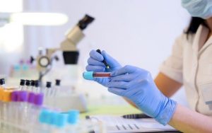 Renal Function Test Product Market