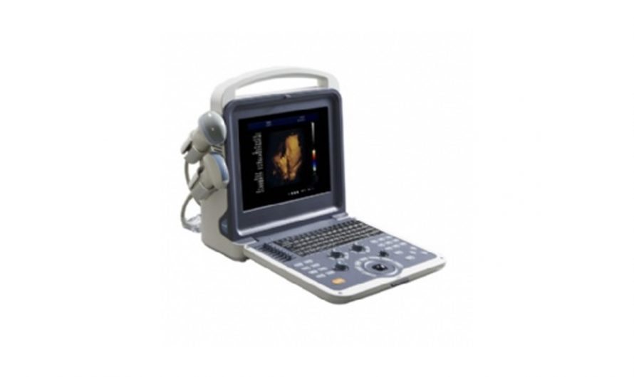 Color Doppler Ultrasound System Market Analysis, Trend, Volume, Size